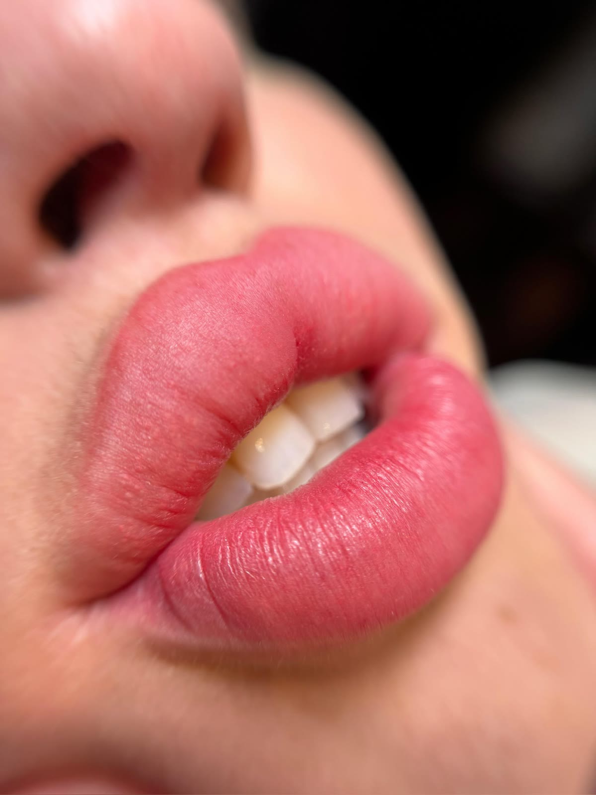 STILETO Lips Resultat