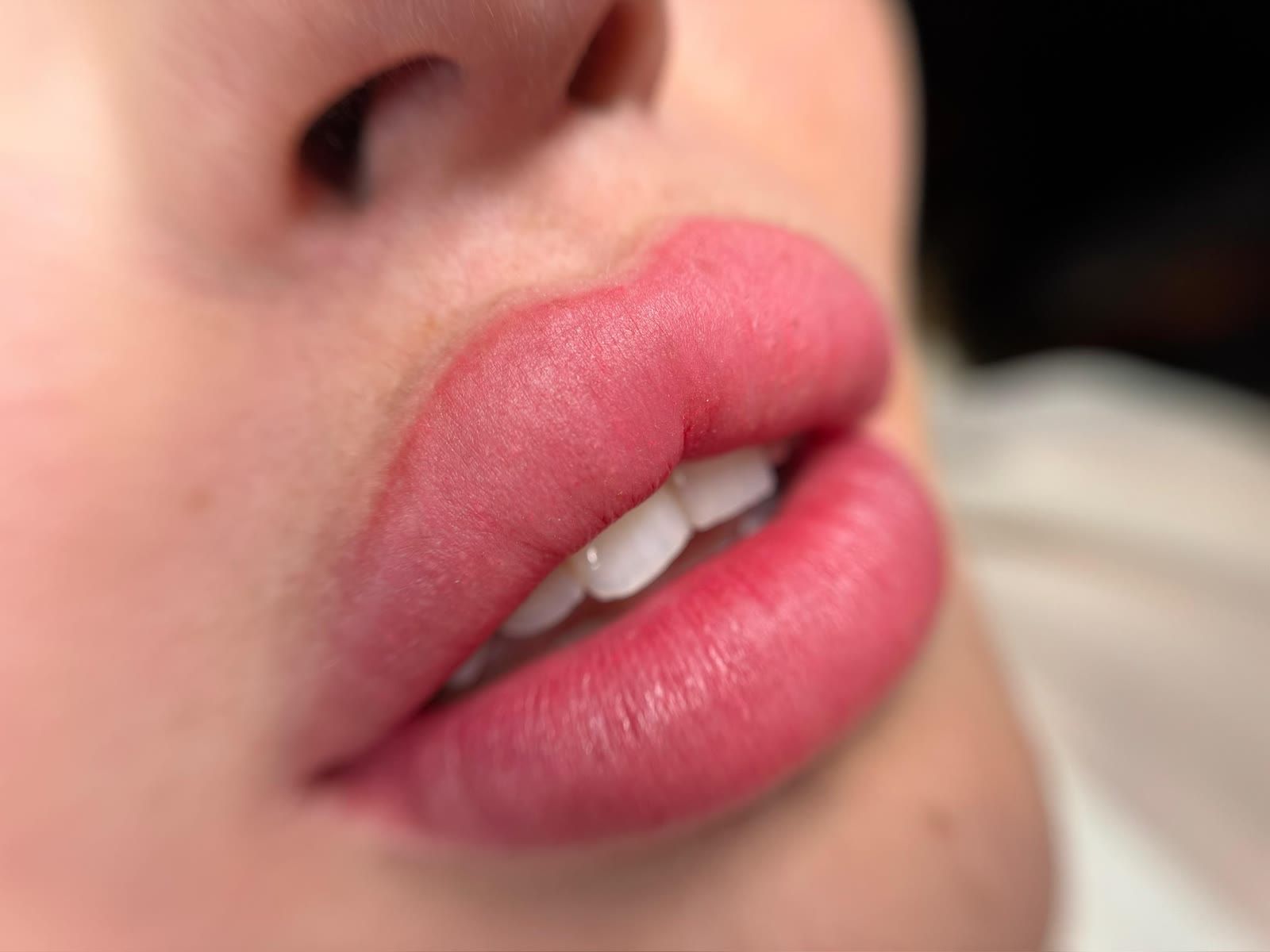 STILETO Lips Resultat